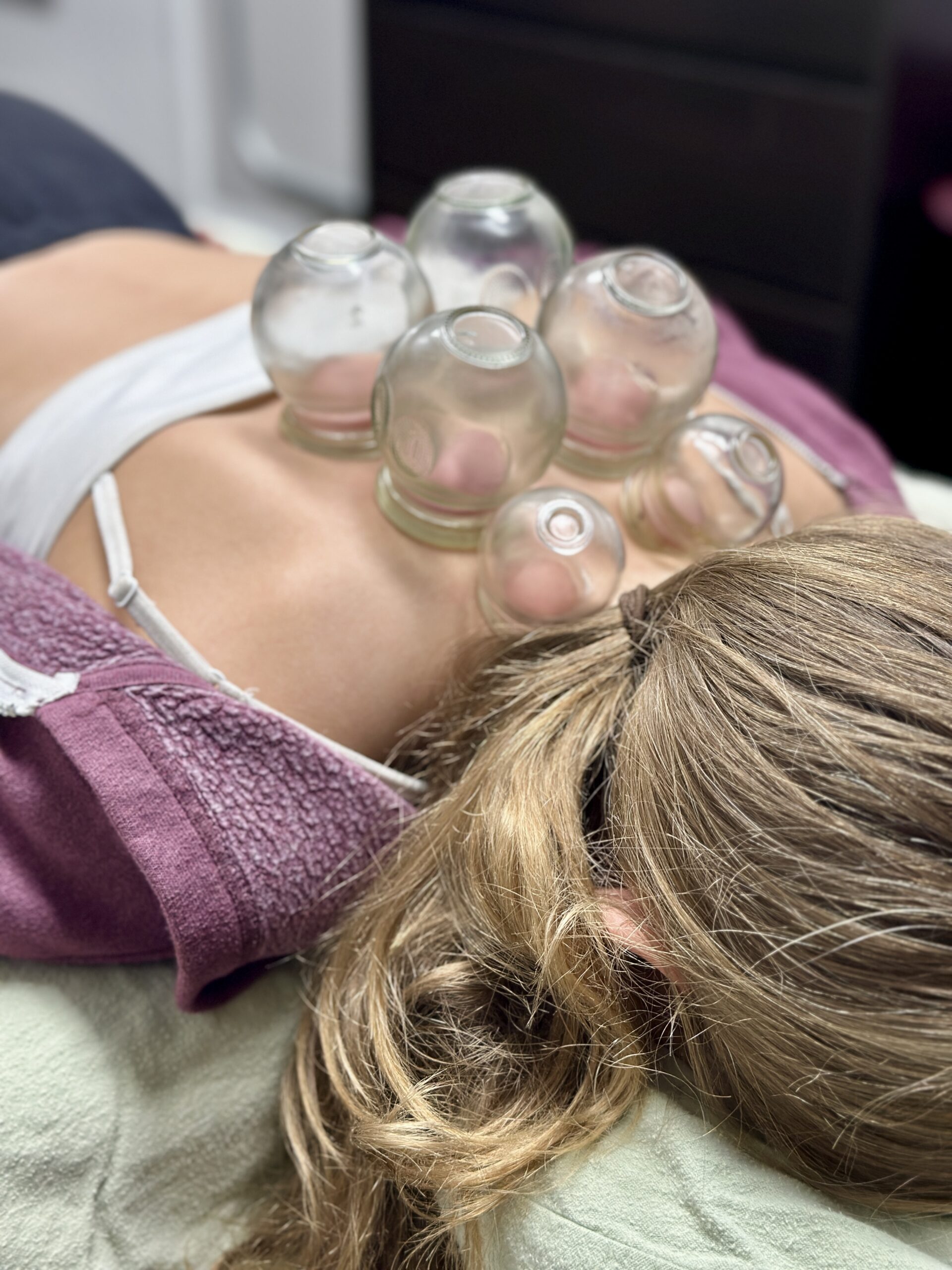 🌀 More on Cupping Therapy — And Why It Helps